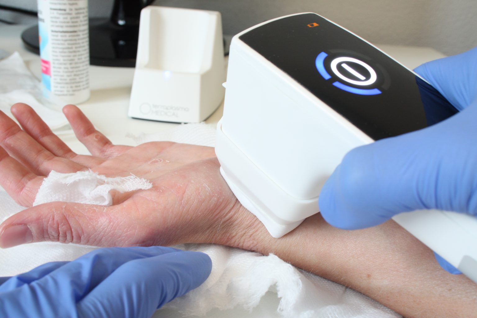 Plasma care® - cold plasma therapy - Wound care technology - DEVICES ...